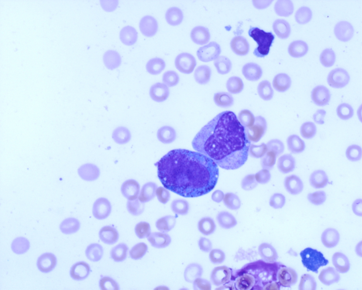 direct smear 60X blast